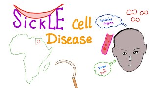 Sickle Cell Disease “Part 1” Intro [upl. by Ilajna637]