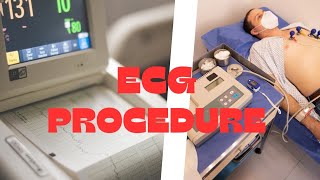 ECG  Procedure of ECG  Fundamental of Nursing  medjeenius youtubevideo nursing [upl. by Eldnik]