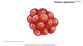 Les tumeurs neuroendocrines TNE  Qu’estce que c’est et quels sont les symptômes [upl. by Therese]