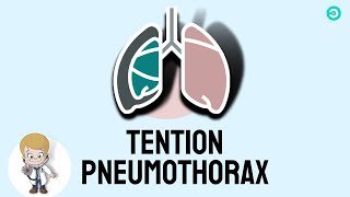 Tension Pneumothorax explained  USMLE [upl. by Trever]