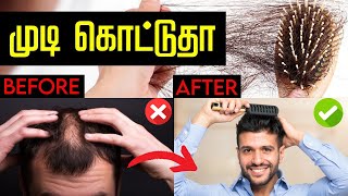 Hair Length vs Density  முடி உதிர்வு பிரச்சனையில் இருந்து தப்பிப்பது எப்படி  Hair Care Secrets [upl. by Annav]