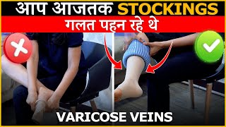 How To Wear Stockings For Varicose Veins  Dr Gaurav Gangwani Interventional Radiologist [upl. by Kciderf]