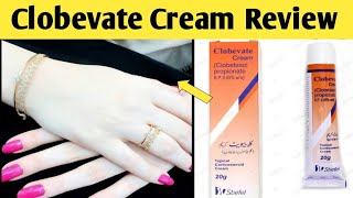 Clobevate Hand Whitening Cream Review Price Benefits Side Effects  Clobevate Cream For Whiten [upl. by Waldemar]