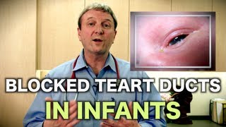 Blocked Tear Ducts in Infants Pediatric Advice [upl. by Lyj]