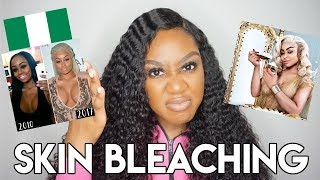 Blac Chyna Endorses 250 Bleaching Cream AND IT WORKS GirlTalk [upl. by Attesoj]