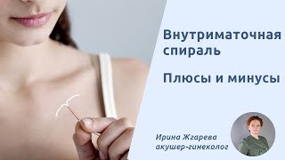 Внутриматочная спираль Плюсы и минусы внутриматочной спирали [upl. by Kikelia]