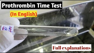 Prothrombin Time Test in EnglishProthrombin TimeProthrombin Time test procedureSTAR LABORATORY [upl. by Harte391]