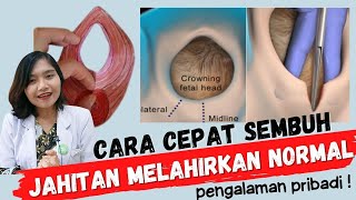 Cara Cepat Sembuh dari Jahitan Melahirkan Normal  dr Ema Surya P [upl. by Alves292]