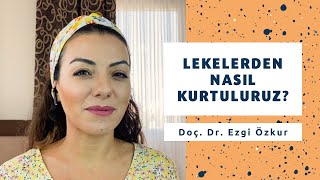 Lekelerden Nasıl Kurtuluruz Lekeler Nasıl Geçer  Doç Dr Ezgi Özkur [upl. by Zelikow]