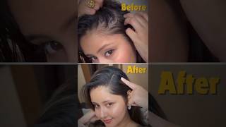 Tried HAIR GROWTH SERUM that actually works ✨hairgrowth hairfall solution longhair healthyhair [upl. by Ahsoek]