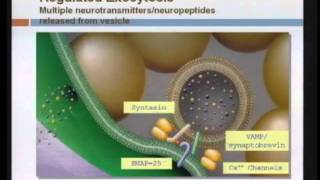 Spasticity Management [upl. by Shaylynn]