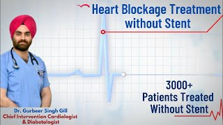 Heart Blockage Treatment without Stent  Oxford Hospital Jalandhar  Dr Gurbeer Singh Gill [upl. by Aver]