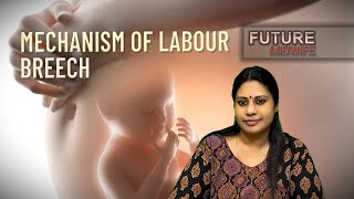 MECHANISM OF LABOURBREECH PRESENTATIONDHANYA DEEPUOBGHIGH RISK LABOUR [upl. by Tterrej]