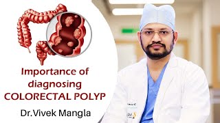 Colorectal polyps What are they and whats their link to colorectal cancer [upl. by Tennek]