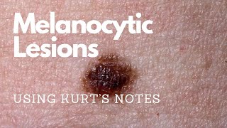 Melanocytic Lesions Kurtâ€™s Notes pathagonia [upl. by Uziel]