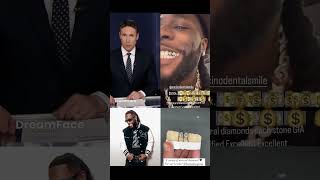 Burna boy buys diamond teeth worth 500000 Burnaboy Afrobeats music teeth diamondteeth [upl. by Reamy]