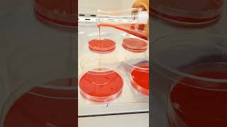 Blood Agar Plates culture microbiology agar [upl. by Aliek409]