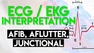 Afib Aflutter Junctional Arrhythmias  ECG EKG Interpretation Part 4 [upl. by Cutter]