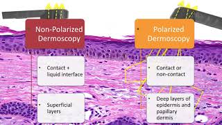 Principles of Dermoscopy  Dr Natalia Jaimes [upl. by Axe]