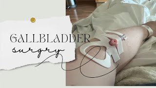 Gallbladder Removal Surgerypre and post op [upl. by Ojeillib]