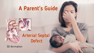 Arterial Septal Defect A Parents Guide [upl. by Yerga382]