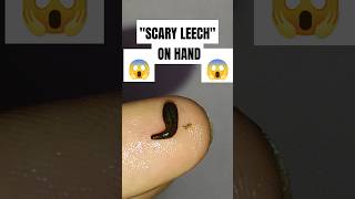 Scary Leech on hand shorts leech insects worms scaryanimal [upl. by Cathleen]