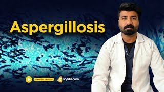 Aspergillosis  Infectious Clinical Medicine  Online Video Lectures  VLearning [upl. by Cedell750]