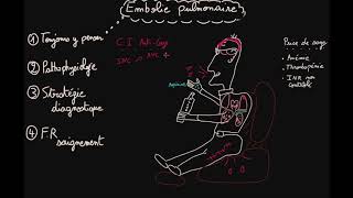 Embolie pulmonaire  Prise en charge  Partie 2  Docteur Synapse [upl. by Dremann]