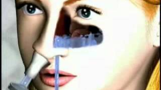 Nasaline Nasal Irrigator [upl. by Odom346]