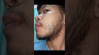 Kirkland Minoxidil Beard Journey 16 WEEK TRANSFORMATION [upl. by Adirem]