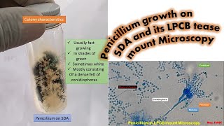 Penicillium growth on SDA and its LPCB tease mount Microscopy [upl. by Jerry458]