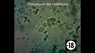 Pneumonie des testiboules au microscope [upl. by Klockau822]