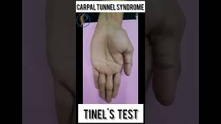 Tinels test for carpal tunnel syndrome physiotherapy carpaltunnalsyndrome physio viral yts [upl. by Libna453]