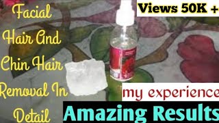 Phitkari for facial hair and chin hair removal  fatima quick reviews [upl. by Ened]