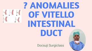 ANOMALIES OF VITELLO INTESTINAL DUCT [upl. by Vidovic]