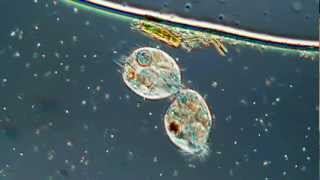 Lamour Or Cell Division in the Ciliated Protozoa Oxytricha 500X [upl. by Ahsirkal]