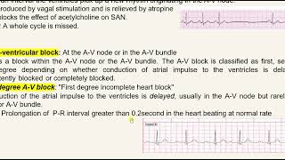 Lecture 7 Abnormal Ecg [upl. by Lyrrehs70]