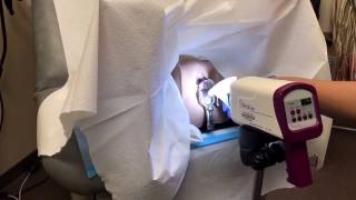 Colposcopy training video [upl. by Birk]