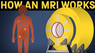 How does an MRI machine work [upl. by Violetta362]