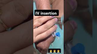 IV Cannula Insertion TechniqueytshortsviralvideodoctorsMedicalPracticeandTalks doctorsdream [upl. by Auhsot977]