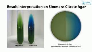 citrate test [upl. by Myrlene138]