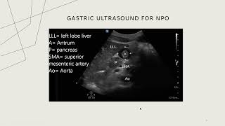 Ultrasound in Anesthesiology and Perioperative Anesthesia [upl. by Aldarcie]