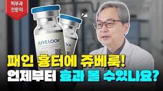 쥬베룩 진짜로 효과가 있는건가요 feat 여드름흉터 패인흉터 [upl. by Rein]