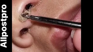 Cleaning baby nose 😍 Super satisfying [upl. by Ellary]