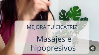 Cicatriz de cesárea hundida Mejora tu cicatriz [upl. by Kape]