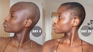 1month update post shaving my hair MY SCALP CARE ROUTINE  Hair Growth [upl. by Way]