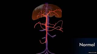 Canine Extrahepatic Portosystemic Shunts  10 Most Common Types  WEISSE 2022 [upl. by Leuams]