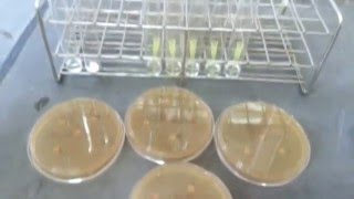 Carbohydrate assimilation test of various yeasts [upl. by Leber]