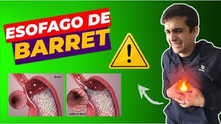 ❌ESOFAGO DE BARRET ¿Qué es Causas  Síntomas  Tratamiento [upl. by Zweig]