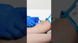 Vein Finder Device shorts facts sciencefacts [upl. by Reace212]